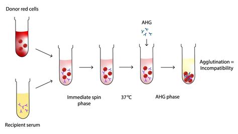 Serological Crossmatch: Principle, Protocol